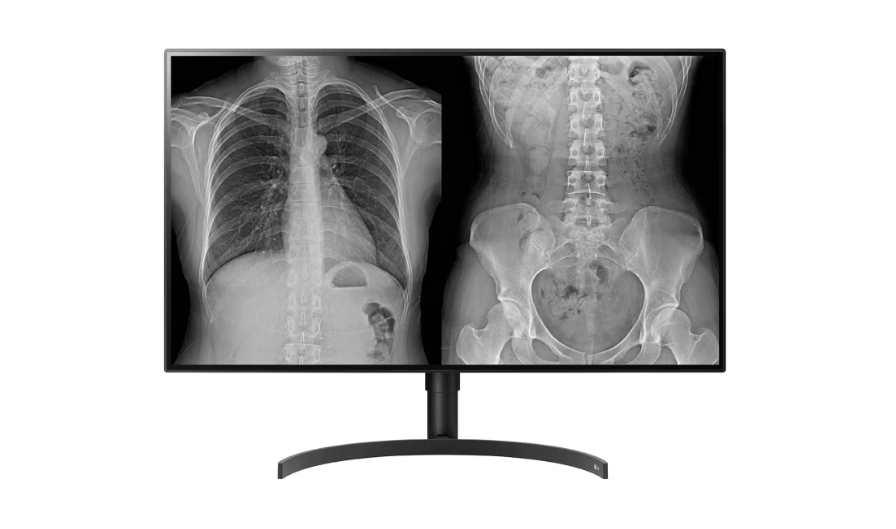 The Innovative Application of LCD Screens in Medical Diagnostic Displays The Innovative Application of LCD Screens in Medical Diagnostic Displays