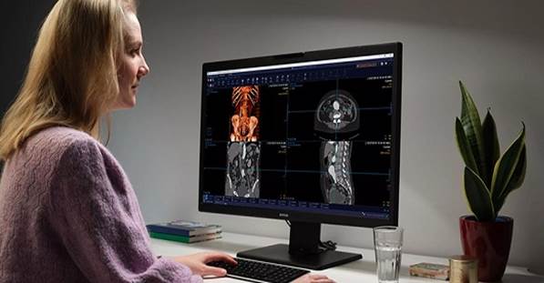 The Innovative Application of LCD Screens in Medical Diagnostic Displays The Innovative Application of LCD Screens in Medical Diagnostic Displays