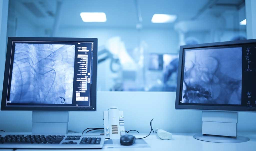 Understanding the Technical Superiority of the G101UAN01.0 LCD Display Understanding the Technical Superiority of the G101UAN01.0 LCD Display